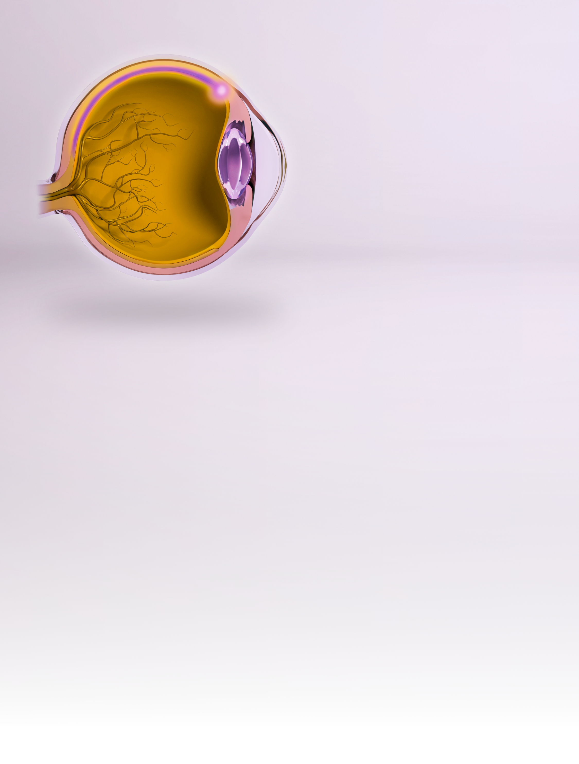 A cross-section of the eye showing the location of the suprachoroidal space between the sclera and choroid